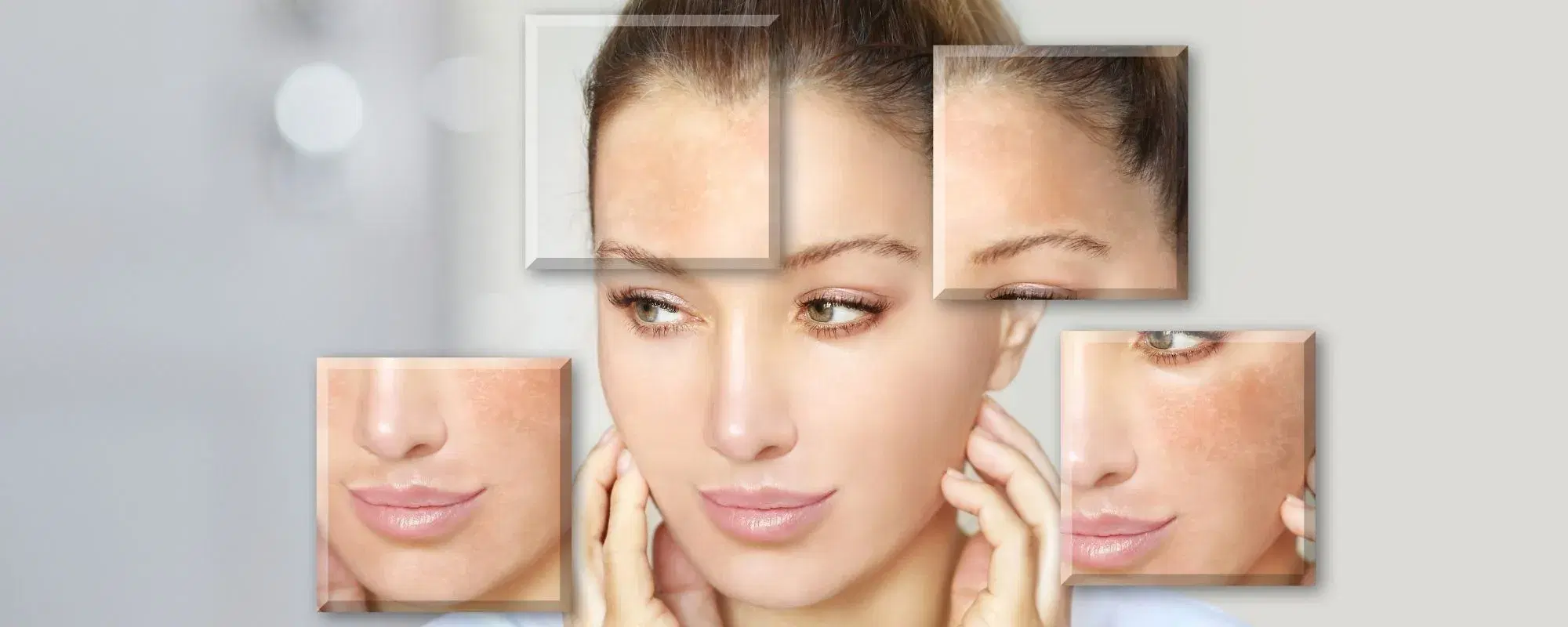 Pelle mista: caratteristiche, cause e soluzioni.