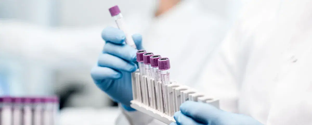 Qual è il rapporto tra colesterolo LDL e HDL e come si calcola?