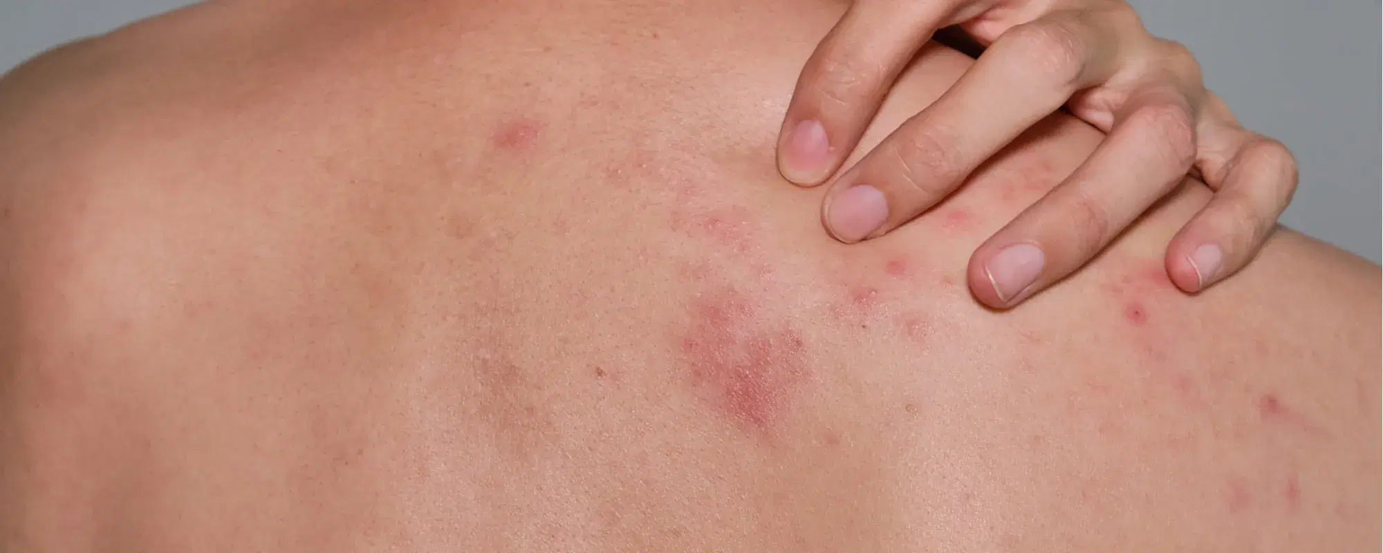 Fuoco di Santo Antonio