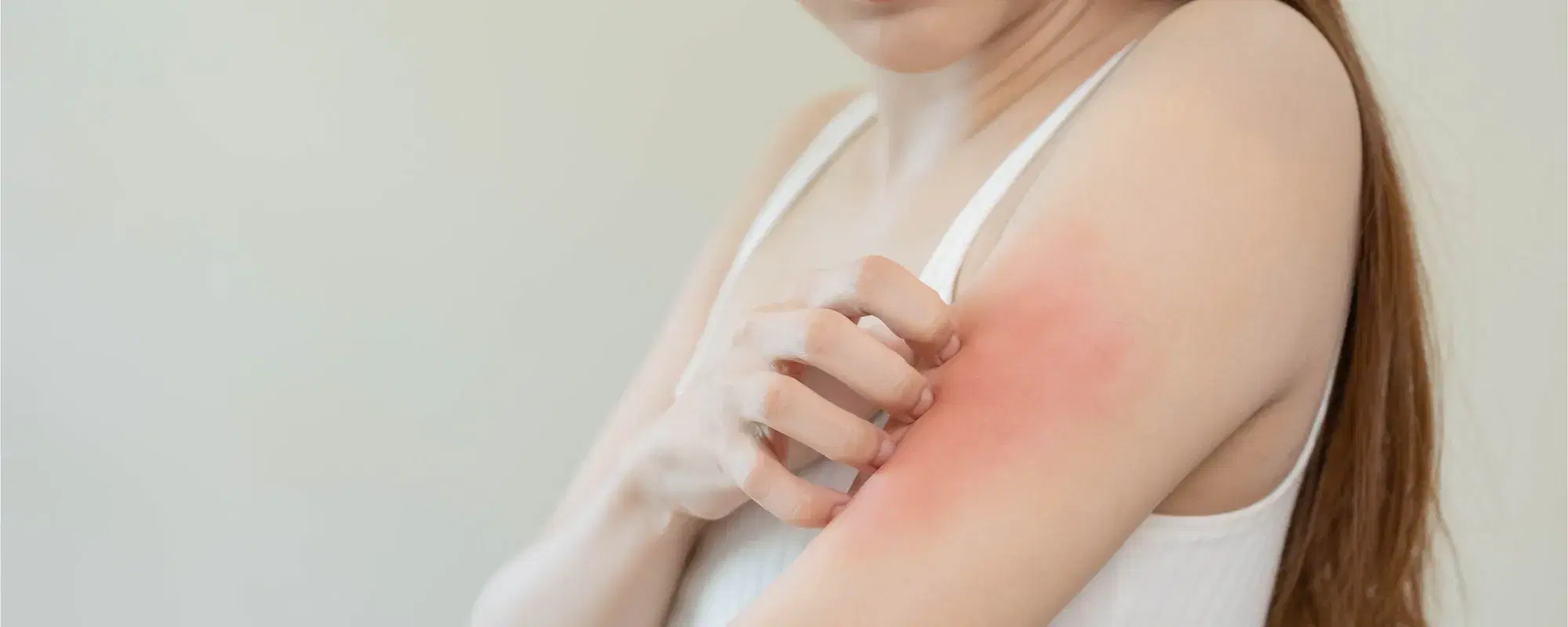 Cosa sapere sulla pelle atopica: significato e consigli per trattarla