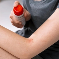 Laboratoires Svr Cicavit Sos Grattage Spray Lenitivo Anti Prurito 40 ml