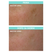 Miamo Triple Brightening Cream Crema Schiarente e Anti Macchie 50 ml