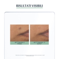 Eucerin DermoPurifyer Oil Control Fluido Protettivo Anti Macchie Mat SPF30 40 ml