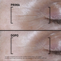 Filorga Time Filler Shot 5XP Siero Concentrato Linee Di Espressione 15 ml