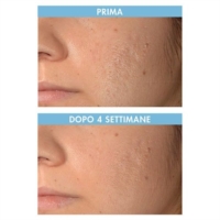 Miamo Acnever Siero Oily Skin Defense Even Tone Sunscreen Drops Spf 50  30 ml