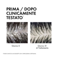 Vichy Dercos 2in1 Shampoo   Balsamo Antiforfora DS 200 ml