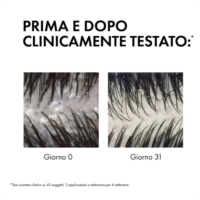 Vichy Dercos Anti Forfora DS Shampoo Trattante Equilibrante Capelli Grassi 400ml